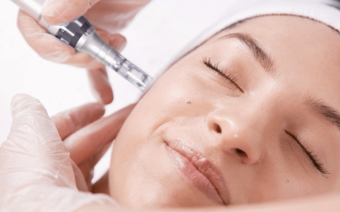 Jetzt neu bei uns RF-Microneedling